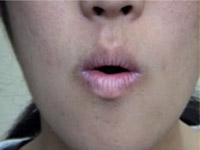 「丘」と「顔」